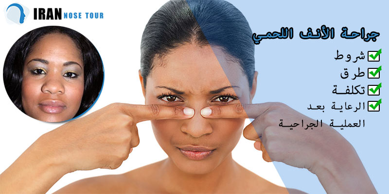 جراحة الأنف اللحمي