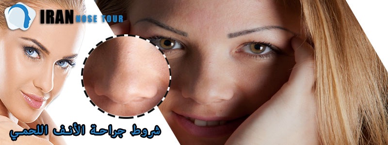 ‎شروط جراحة الأنف اللحمي