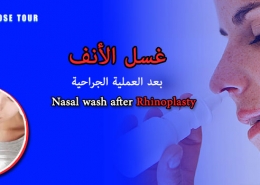 ‎غسل الأنف بعد العملیة الجراحية