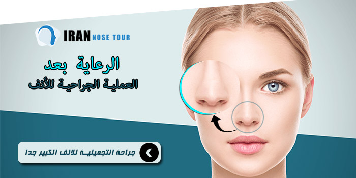 الرعاية بعد العملية الجراحية للأنف السمين للغاية