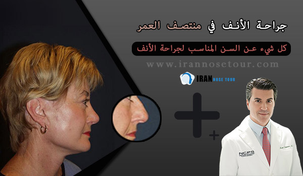جراحة الأنف في منتصف العمر