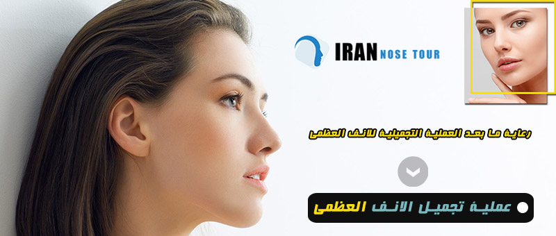 رعاية ما بعد العملية التجميلية للانف العظمي
