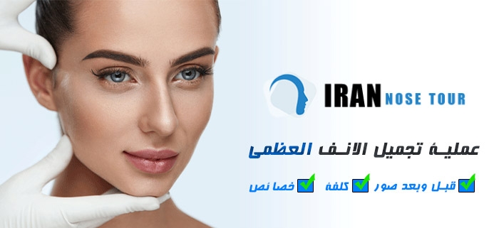 عملية تجميل الانف العظمي